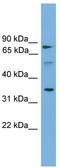 Solute Carrier Family 51 Alpha Subunit antibody, TA338900, Origene, Western Blot image 