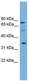 Solute Carrier Family 51 Alpha Subunit antibody, TA338900, Origene, Western Blot image 