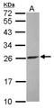 ATP Synthase Peripheral Stalk-Membrane Subunit B antibody, NBP2-15513, Novus Biologicals, Western Blot image 