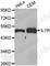 Interleukin 7 Receptor antibody, A1230, ABclonal Technology, Western Blot image 