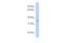 Glyoxylate And Hydroxypyruvate Reductase antibody, A06963, Boster Biological Technology, Western Blot image 