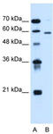 ALG11 Alpha-1,2-Mannosyltransferase antibody, TA335312, Origene, Western Blot image 