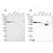 Solute Carrier Family 25 Member 12 antibody, PA5-57234, Invitrogen Antibodies, Western Blot image 