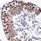 Protein Arginine Methyltransferase 5 antibody, GTX00832, GeneTex, Immunohistochemistry paraffin image 