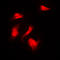 Ribosomal Protein S6 Kinase B1 antibody, LS-C352825, Lifespan Biosciences, Immunofluorescence image 