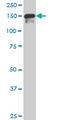 SPT5 Homolog, DSIF Elongation Factor Subunit antibody, LS-C133459, Lifespan Biosciences, Western Blot image 