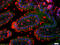 Colony Stimulating Factor 2 Receptor Alpha Subunit antibody, GTX51383, GeneTex, Immunohistochemistry paraffin image 