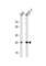 Carbonic Anhydrase 2 antibody, abx033312, Abbexa, Western Blot image 