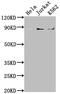 Inhibitor Of Nuclear Factor Kappa B Kinase Subunit Beta antibody, CSB-RA261933A0HU, Cusabio, Western Blot image 