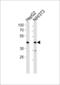 Nuclear Receptor Subfamily 2 Group F Member 2 antibody, LS-B10669, Lifespan Biosciences, Western Blot image 