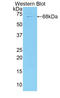 Collagen Type XVIII Alpha 1 Chain antibody, LS-C293448, Lifespan Biosciences, Western Blot image 