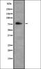 TGF-Beta Activated Kinase 1 (MAP3K7) Binding Protein 3 antibody, orb337162, Biorbyt, Western Blot image 