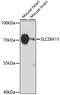 Solute Carrier Family 26 Member 11 antibody, 16-902, ProSci, Western Blot image 