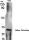 Aldose reductase antibody, STJ91559, St John