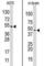 Hypoxia Inducible Factor 1 Subunit Alpha Inhibitor antibody, abx025671, Abbexa, Western Blot image 