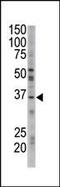 Geranylgeranyl Diphosphate Synthase 1 antibody, PA5-12167, Invitrogen Antibodies, Western Blot image 