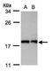 Anaphase Promoting Complex Subunit 11 antibody, PA5-29148, Invitrogen Antibodies, Western Blot image 