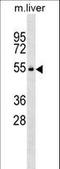 VRK Serine/Threonine Kinase 2 antibody, LS-C158285, Lifespan Biosciences, Western Blot image 