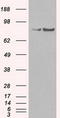 SATB Homeobox 1 antibody, LS-C114621, Lifespan Biosciences, Western Blot image 