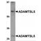 ADAMTS Like 5 antibody, MBS150785, MyBioSource, Western Blot image 