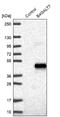 Beta-1,4-Galactosyltransferase 7 antibody, NBP1-88652, Novus Biologicals, Western Blot image 