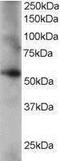 Coronin 1C antibody, PA1-31250, Invitrogen Antibodies, Western Blot image 