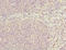 DEAD-Box Helicase 20 antibody, LS-C675632, Lifespan Biosciences, Immunohistochemistry paraffin image 