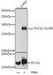 Phospholipase C Gamma 1 antibody, LS-C750633, Lifespan Biosciences, Western Blot image 