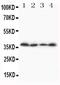 Stimulated by retinoic acid gene 8 protein antibody, PA5-80082, Invitrogen Antibodies, Western Blot image 