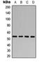 Aldehyde Dehydrogenase 1 Family Member A1 antibody, orb235004, Biorbyt, Western Blot image 
