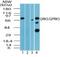 G Protein-Coupled Receptor Kinase 5 antibody, NBP2-24580, Novus Biologicals, Western Blot image 