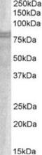 Sorting Nexin 18 antibody, MBS420077, MyBioSource, Western Blot image 