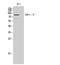 Component Of Inhibitor Of Nuclear Factor Kappa B Kinase Complex antibody, STJ93666, St John