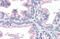 Vitamin D Receptor antibody, orb329595, Biorbyt, Immunohistochemistry paraffin image 