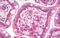 c-met antibody, orb96316, Biorbyt, Immunohistochemistry paraffin image 