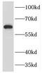 HAUS Augmin Like Complex Subunit 3 antibody, FNab03763, FineTest, Western Blot image 