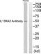 Interleukin 13 Receptor Subunit Alpha 2 antibody, PA5-39584, Invitrogen Antibodies, Western Blot image 