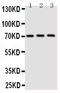 Eukaryotic Translation Initiation Factor 2 Alpha Kinase 1 antibody, PA2024, Boster Biological Technology, Western Blot image 