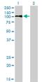 Low Density Lipoprotein Receptor antibody, H00003949-M01, Novus Biologicals, Western Blot image 