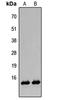 Histone H2B antibody, LS-C356084, Lifespan Biosciences, Western Blot image 