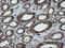 Protein Disulfide Isomerase Family A Member 3 antibody, LS-C337796, Lifespan Biosciences, Immunohistochemistry paraffin image 