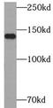 Calcium Homeostasis Endoplasmic Reticulum Protein antibody, FNab01647, FineTest, Western Blot image 