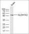 Aldehyde Dehydrogenase 1 Family Member A2 antibody, orb182434, Biorbyt, Western Blot image 