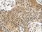 Perilipin 3 antibody, LS-C403423, Lifespan Biosciences, Immunohistochemistry paraffin image 