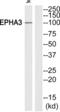 EPH Receptor A3 antibody, abx013007, Abbexa, Western Blot image 