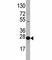 Eukaryotic Translation Initiation Factor 4E antibody, F47410-0.4ML, NSJ Bioreagents, Western Blot image 