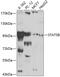Signal Transducer And Activator Of Transcription 5B antibody, 13-121, ProSci, Western Blot image 