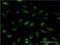 Eukaryotic Translation Initiation Factor 4E Binding Protein 1 antibody, H00001978-M01, Novus Biologicals, Immunocytochemistry image 