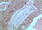 Janus Kinase 2 antibody, STJ98896, St John
