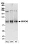 ATPase Sarcoplasmic/Endoplasmic Reticulum Ca2+ Transporting 2 antibody, NB100-237, Novus Biologicals, Western Blot image 